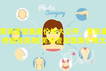 芜湖壹加医美价格大公开，整形案例惊艳亮相(芜湖壹加医美价格大公开,整形 🌲 案例惊艳亮相)